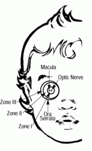 Zones1