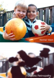 your vision with diabetic retinopathy